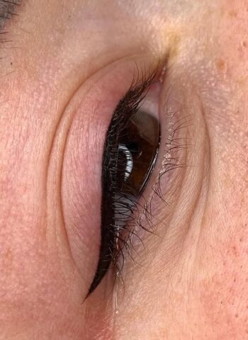 Kontúr szemhéj Kontúr szemhéj